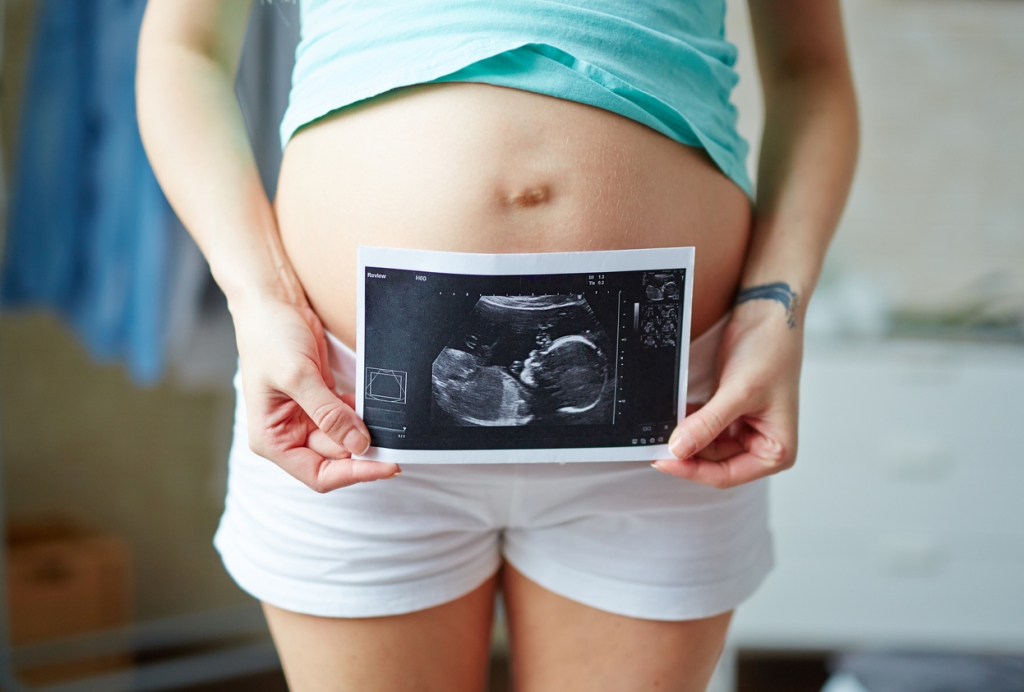 Woman Holding Ultrasound Photo in Front of Pregnant Belly