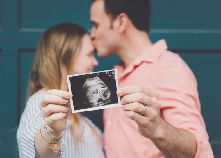 Couple Holding Sonography